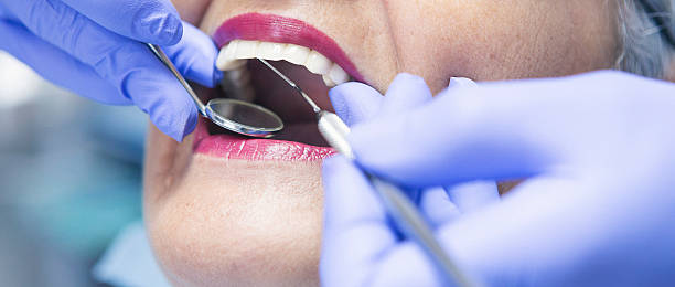Best Emergency Dental Services for Seniors in Asbury Lake, FL